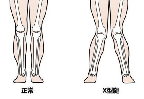 更新赣州薇琳整形收费价目表，其中X型腿矫正3w+双眼皮修复1w+超皮秒2980+