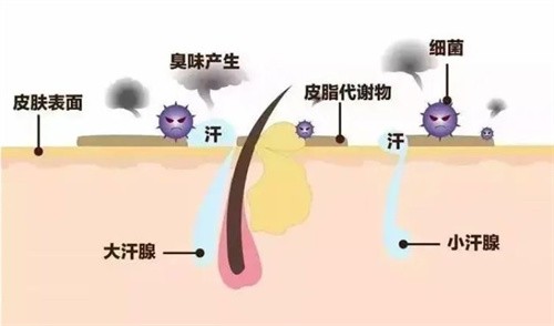 Miradry微波腋臭容易复发吗？大概率会复发，揭秘高复发率背后的真相