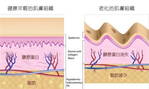 艾塑菲童颜针打一次有用吗？有细微成效，普遍打2~3次的成效更满意