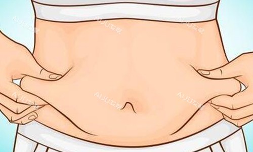 生娃后肚子上皮肤松弛下垂怎么改善？选腹壁成形术，本文包含原理/优势/适合人群