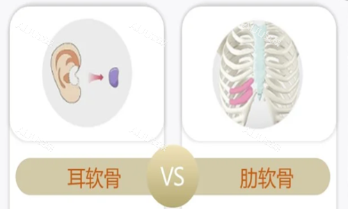 隆鼻材料示意图