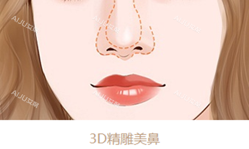 3D精雕美鼻示意图