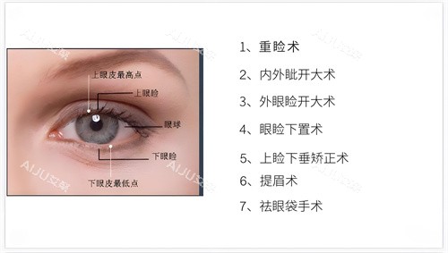 眼综合整形包含的部分项目演示图