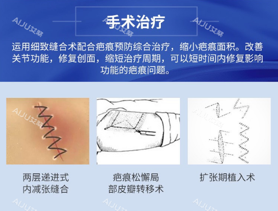 非手术祛疤的原理