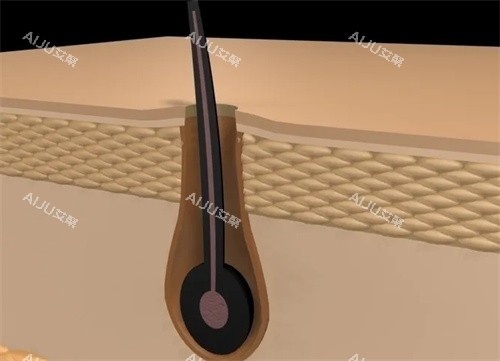 毛囊放大照片