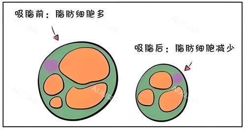 吸脂前后脂肪细胞对比动画图