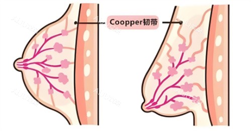 乳房下垂韧带组织对比