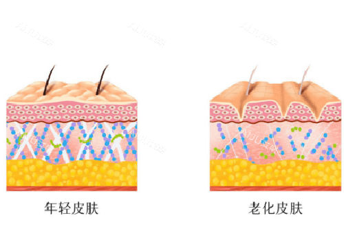 平滑皮肤和有皱纹皮肤示意图