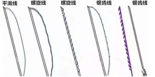 埋线线材线的结构演示图