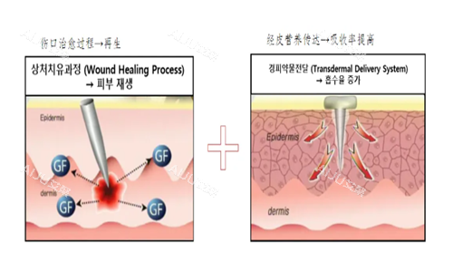 焕水换肤中胚层管理