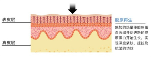 悦白之几胶原蛋白的功效有什么？包含重塑皮肤弹性|修复屏障|提亮肤色等