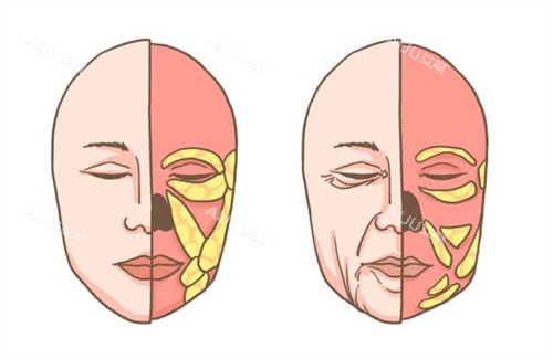 面部衰老卡通图对比