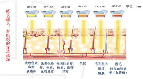 刷酶和光子嫩肤的区别在哪？主要功效不同~针对不同皮肤状态选择适合自己的！