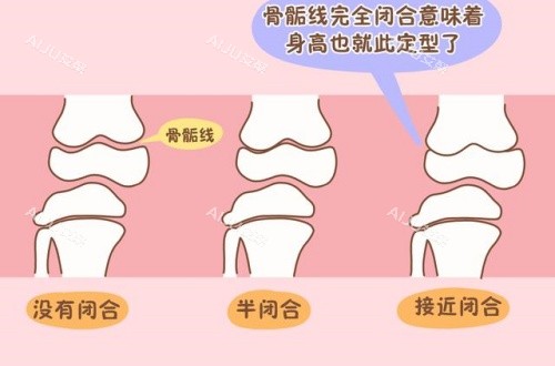 骨骺线联合提升条件