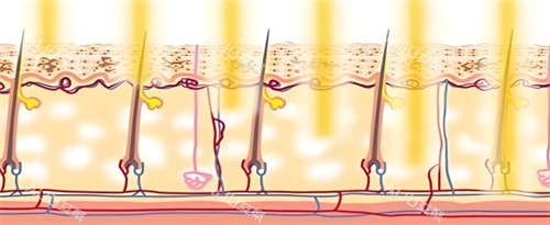 光子嫩肤作用图