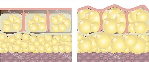 自体脂肪填充前后皮肤层动画图