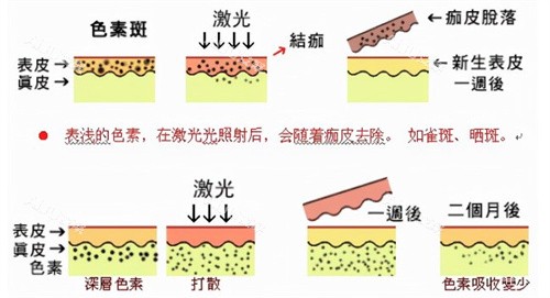 皮秒的原理素材