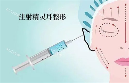 精灵耳注射动画图