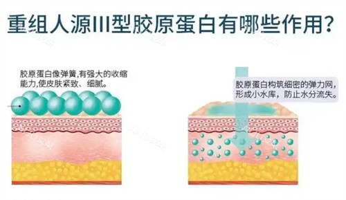 重组三型胶原蛋白有哪些作用