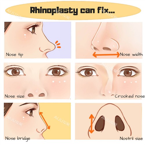 鼻修复流程图