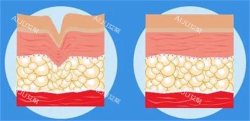 爱塑美童颜针注射前后对比图