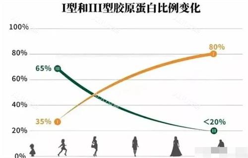 I型和III型胶原蛋白的变化