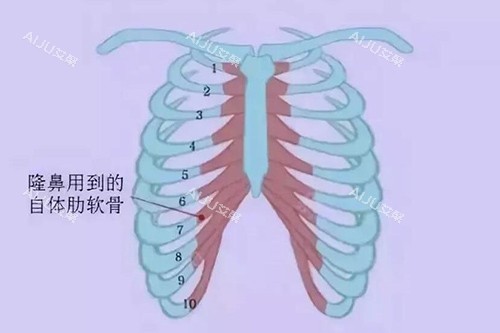 手术中一般用到的肋软骨材料